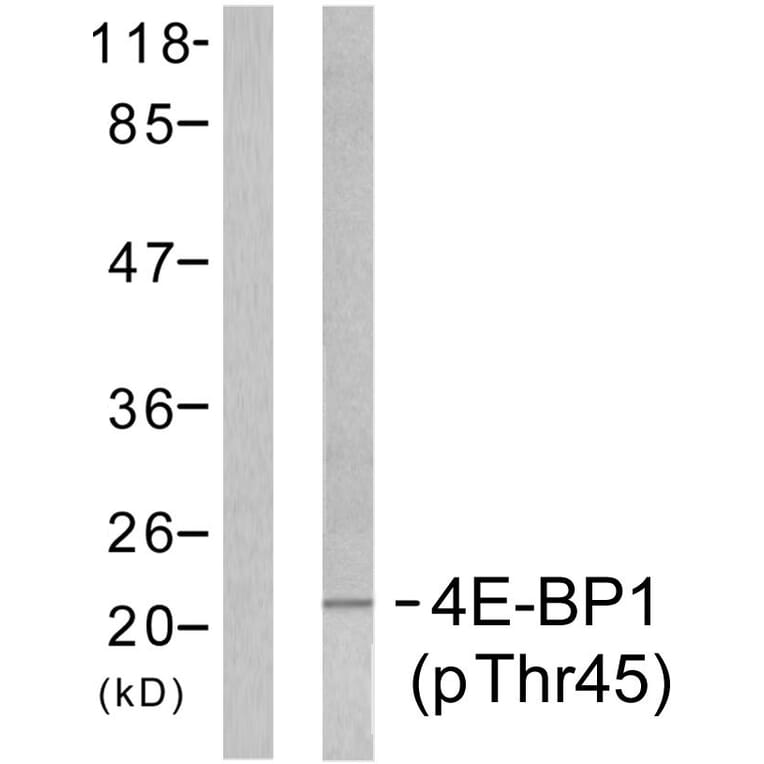 Western Blot - Anti-4E-BP1 (phospho Thr45) Antibody (A7002) - Antibodies.com