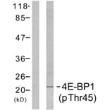 Western Blot - Anti-4E-BP1 (phospho Thr45) Antibody (A7002) - Antibodies.com