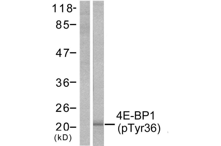 Western Blot - Anti-4E-BP1 (phospho Thr36) Antibody (A7001) - Antibodies.com