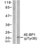 Western Blot - Anti-4E-BP1 (phospho Thr36) Antibody (A7001) - Antibodies.com