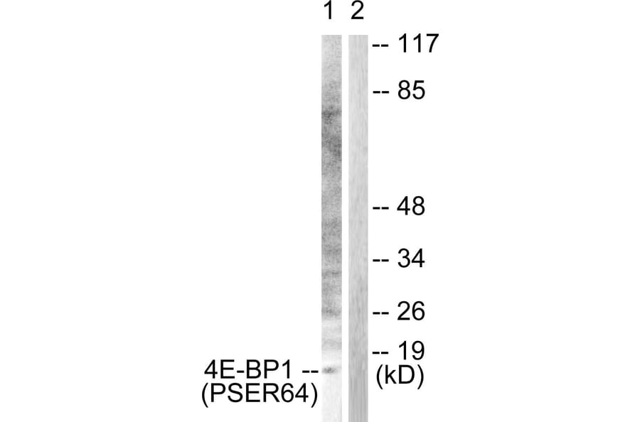 Western Blot - Anti-4E-BP1 (phospho Ser64) Antibody (A0401) - Antibodies.com