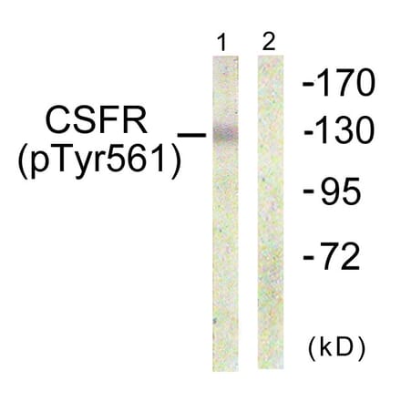 Western Blot - Anti-CSFR (phospho Tyr561) Antibody (A0877) - Antibodies.com