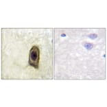 Immunohistochemistry - Anti-CSFR (phospho Tyr561) Antibody (A0877) - Antibodies.com