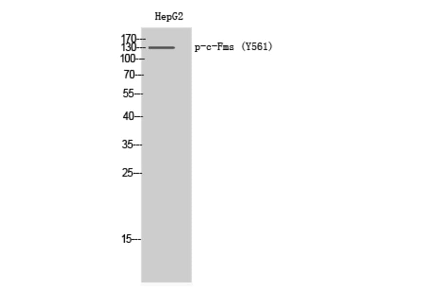 Western Blot - Anti-CSFR (phospho Tyr561) Antibody (A0877) - Antibodies.com