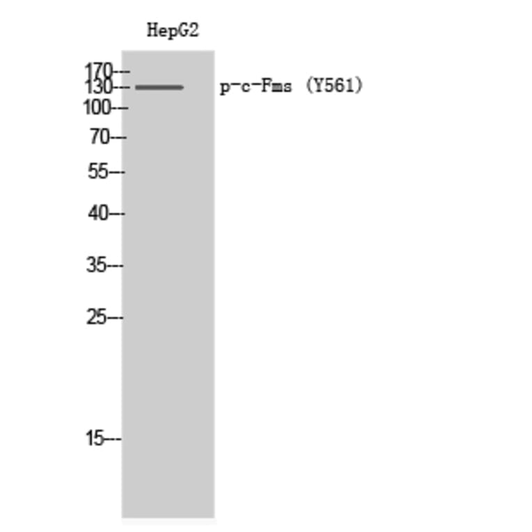 Western Blot - Anti-CSFR (phospho Tyr561) Antibody (A0877) - Antibodies.com