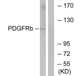 Western Blot - Anti-PDGF Receptor beta Antibody (B7194) - Antibodies.com