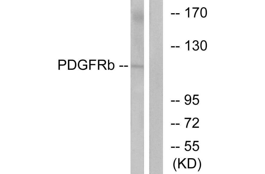 Western Blot - Anti-PDGF Receptor beta Antibody (B7194) - Antibodies.com