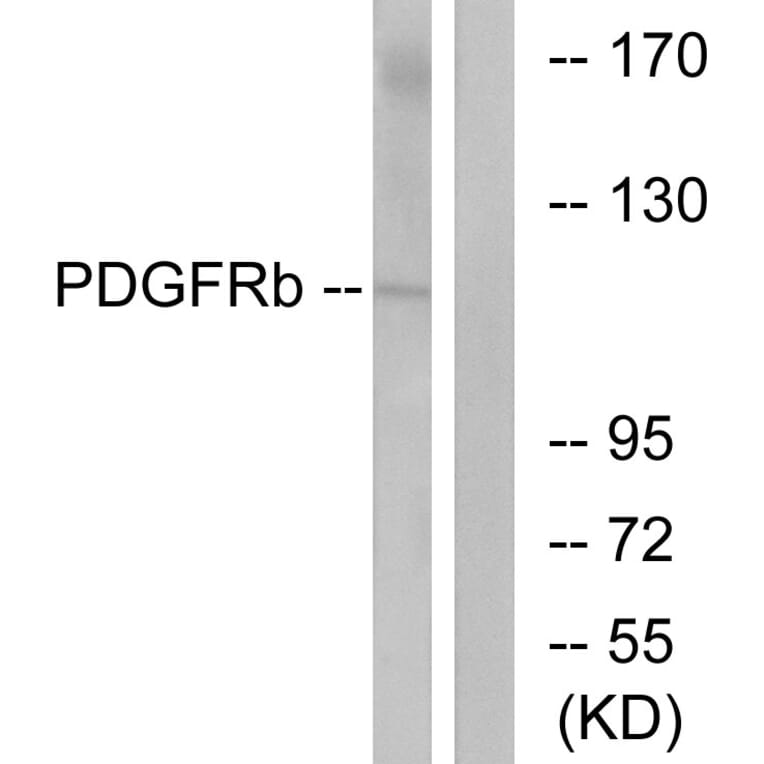Western Blot - Anti-PDGF Receptor beta Antibody (B7194) - Antibodies.com