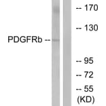 Western Blot - Anti-PDGF Receptor beta Antibody (B7194) - Antibodies.com