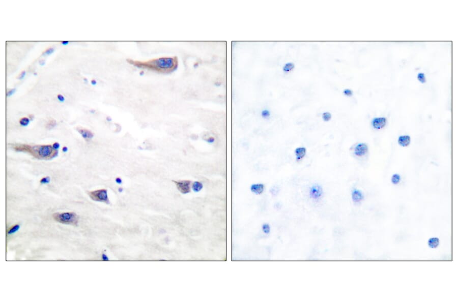 Immunohistochemistry - Anti-PDGF Receptor beta Antibody (B7194) - Antibodies.com