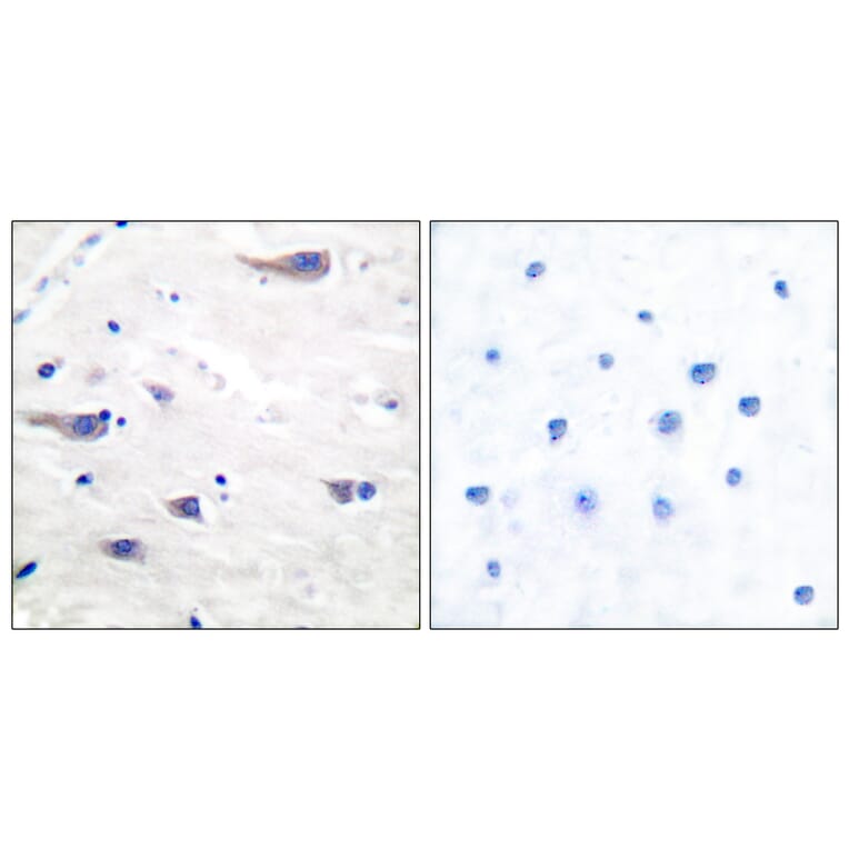 Immunohistochemistry - Anti-PDGF Receptor beta Antibody (B7194) - Antibodies.com