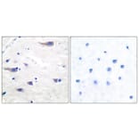 Immunohistochemistry - Anti-PDGF Receptor beta Antibody (B7194) - Antibodies.com