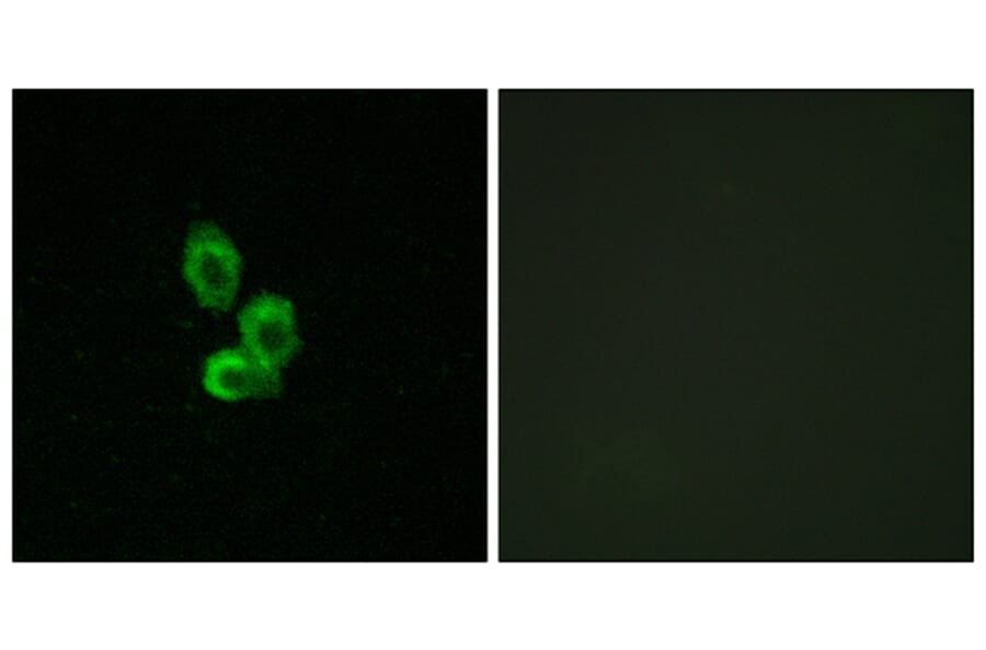 Immunofluorescence - Anti-PDGF Receptor beta Antibody (B7194) - Antibodies.com
