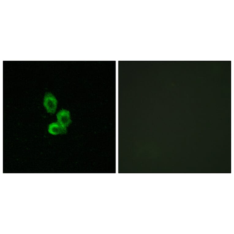 Immunofluorescence - Anti-PDGF Receptor beta Antibody (B7194) - Antibodies.com