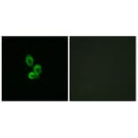 Immunofluorescence - Anti-PDGF Receptor beta Antibody (B7194) - Antibodies.com