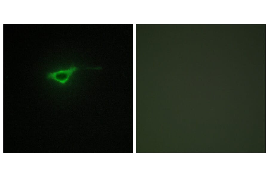 Immunofluorescence - Anti-Collagen XX alpha1 Antibody (C12225) - Antibodies.com