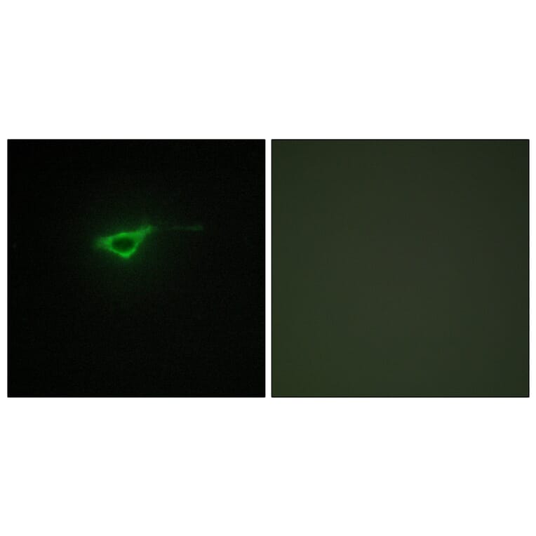 Immunofluorescence - Anti-Collagen XX alpha1 Antibody (C12225) - Antibodies.com
