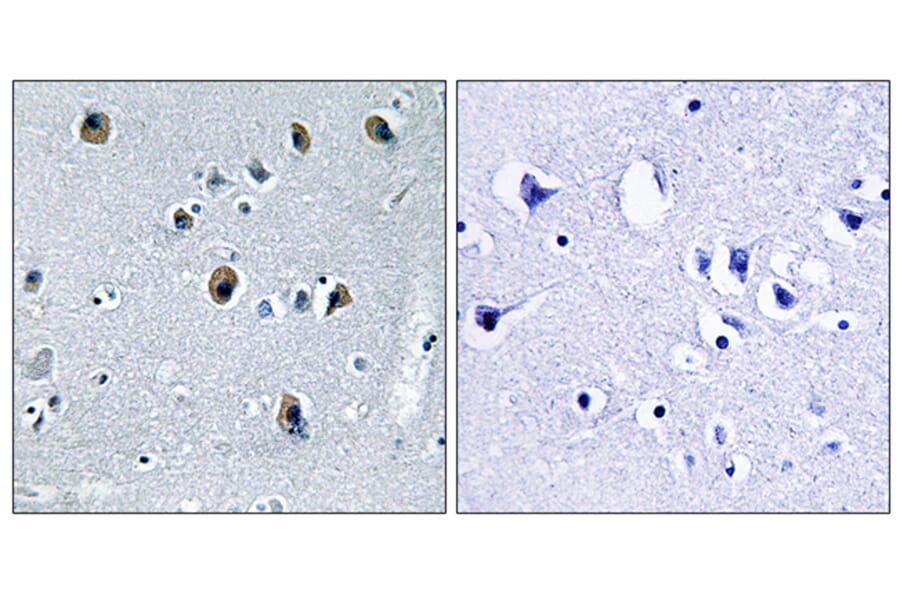Immunohistochemistry - Anti-Collagen XX alpha1 Antibody (C12225) - Antibodies.com