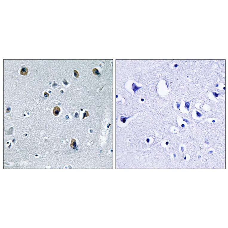 Immunohistochemistry - Anti-Collagen XX alpha1 Antibody (C12225) - Antibodies.com