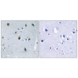 Immunohistochemistry - Anti-Collagen XX alpha1 Antibody (C12225) - Antibodies.com