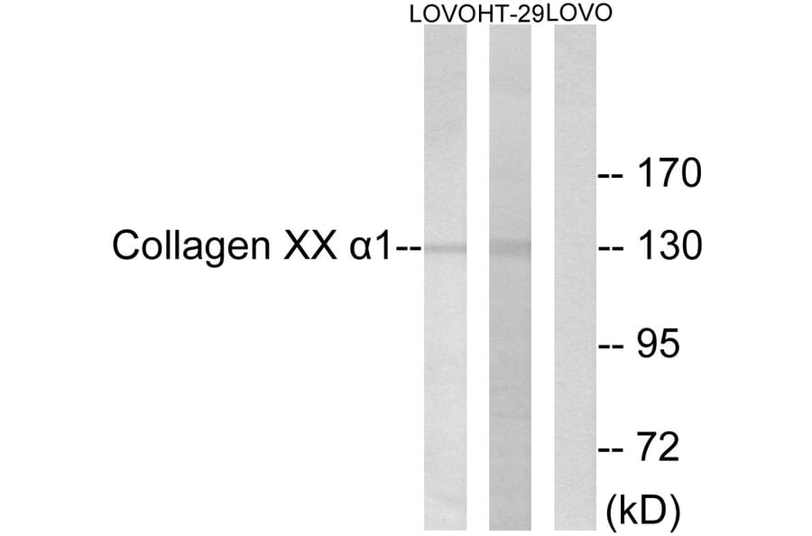 Western Blot - Anti-Collagen XX alpha1 Antibody (C12225) - Antibodies.com