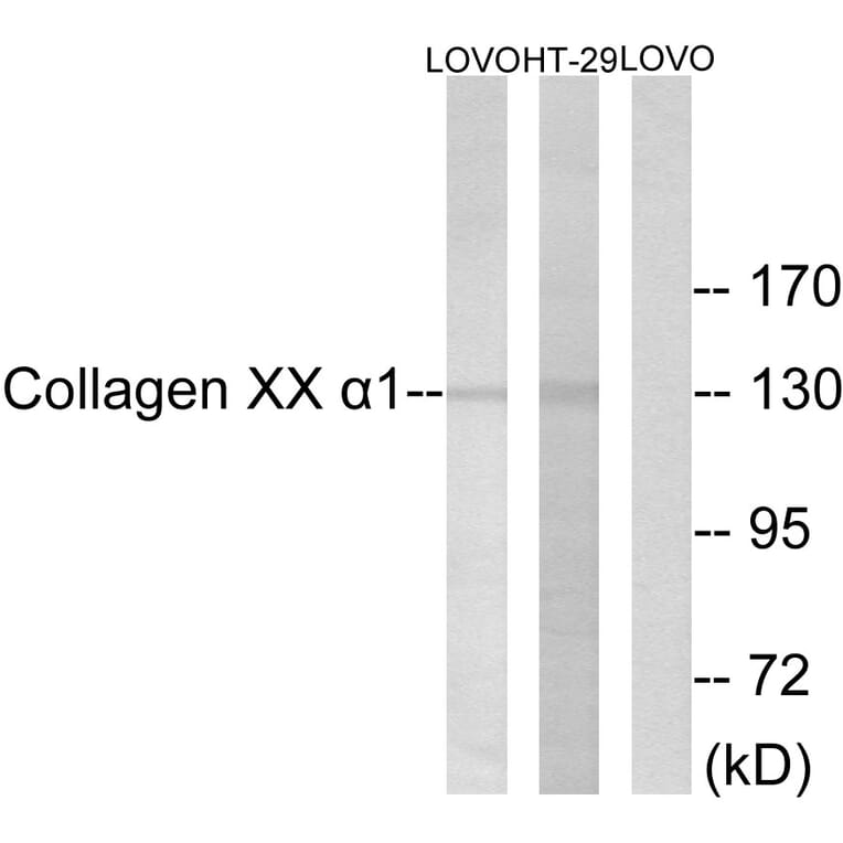 Western Blot - Anti-Collagen XX alpha1 Antibody (C12225) - Antibodies.com