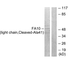 Western Blot - Anti-FA10 (light chain,cleaved Ala41) Antibody (L0199) - Antibodies.com
