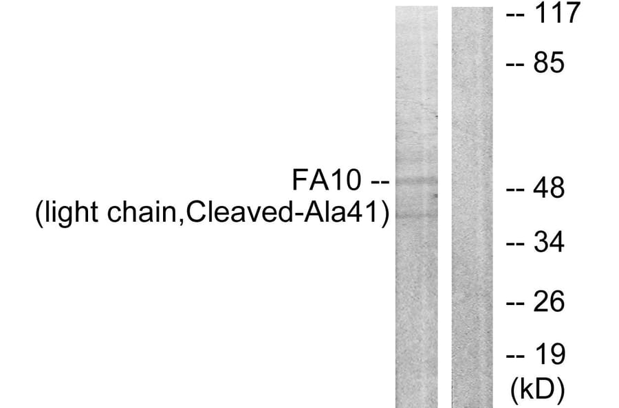 Western Blot - Anti-FA10 (light chain,cleaved Ala41) Antibody (L0199) - Antibodies.com