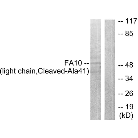 Western Blot - Anti-FA10 (light chain,cleaved Ala41) Antibody (L0199) - Antibodies.com