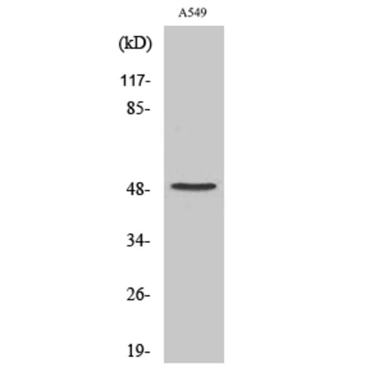 Western Blot - Anti-FA10 (light chain,cleaved Ala41) Antibody (L0199) - Antibodies.com