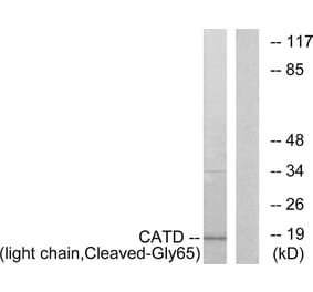 Western Blot - Anti-CATD (light chain,cleaved Gly65) Antibody (L0175) - Antibodies.com