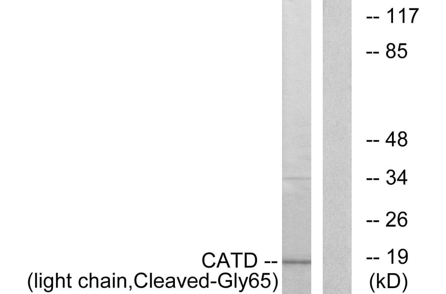 Western Blot - Anti-CATD (light chain,cleaved Gly65) Antibody (L0175) - Antibodies.com