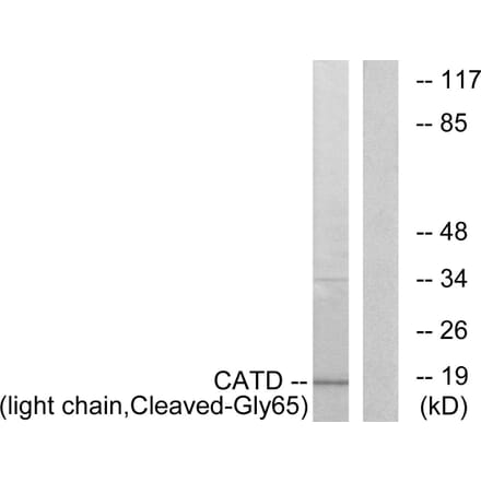 Western Blot - Anti-CATD (light chain,cleaved Gly65) Antibody (L0175) - Antibodies.com