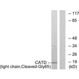 Western Blot - Anti-CATD (light chain,cleaved Gly65) Antibody (L0175) - Antibodies.com
