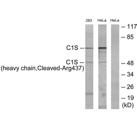 Western Blot - Anti-C1S (heavy chain,cleaved Arg437) Antibody (L0231) - Antibodies.com