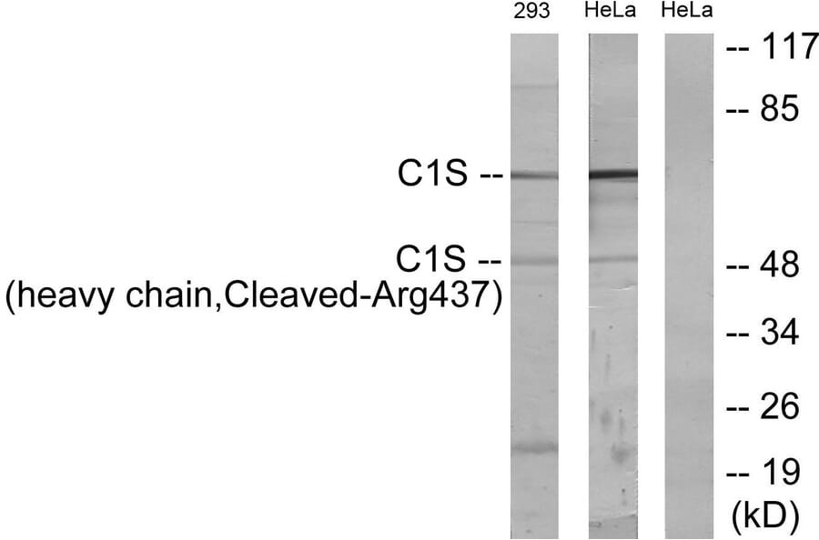 Western Blot - Anti-C1S (heavy chain,cleaved Arg437) Antibody (L0231) - Antibodies.com