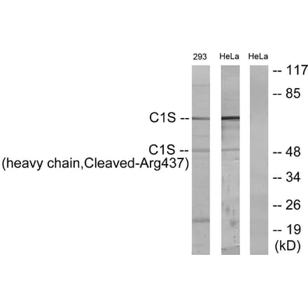 Western Blot - Anti-C1S (heavy chain,cleaved Arg437) Antibody (L0231) - Antibodies.com