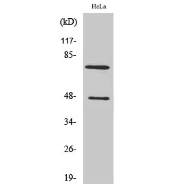 Western Blot - Anti-C1S (heavy chain,cleaved Arg437) Antibody (L0231) - Antibodies.com