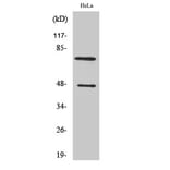 Western Blot - Anti-C1S (heavy chain,cleaved Arg437) Antibody (L0231) - Antibodies.com