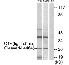 Western Blot - Anti-C1R (light chain,cleaved Ile464) Antibody (L0230) - Antibodies.com