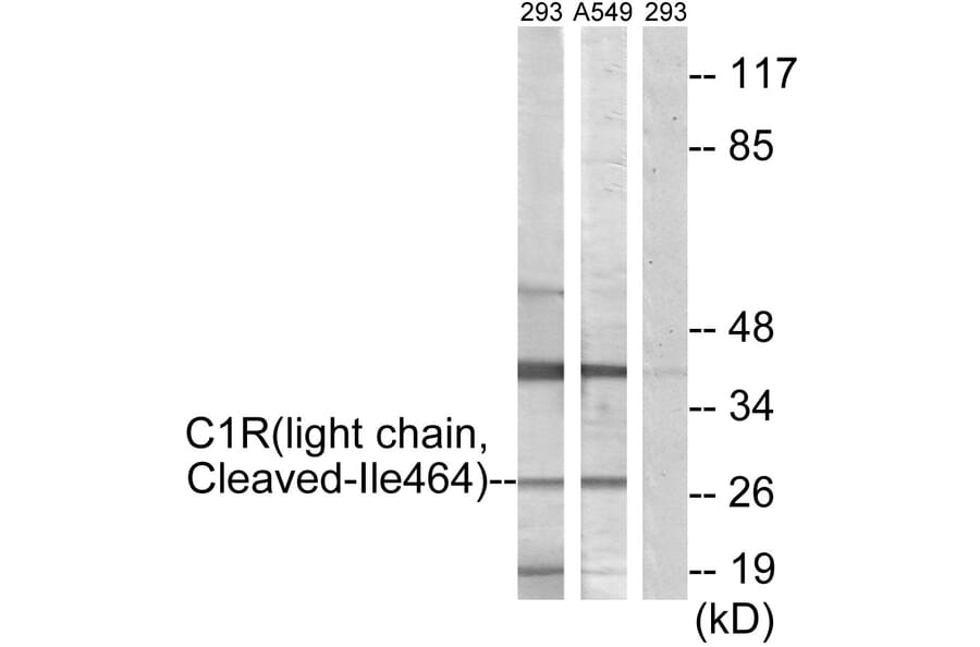 Western Blot - Anti-C1R (light chain,cleaved Ile464) Antibody (L0230) - Antibodies.com