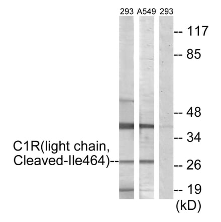 Western Blot - Anti-C1R (light chain,cleaved Ile464) Antibody (L0230) - Antibodies.com