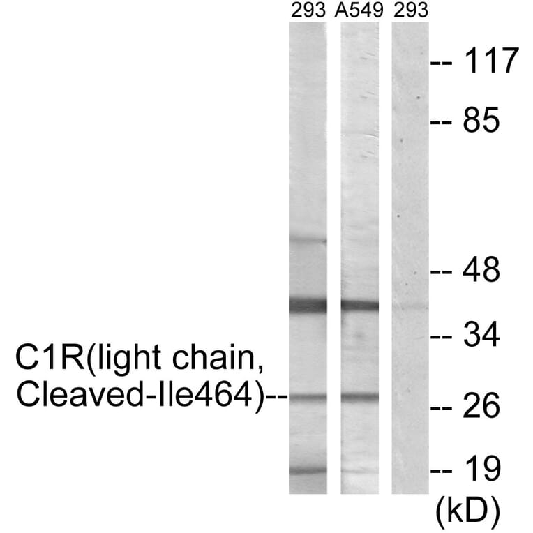 Western Blot - Anti-C1R (light chain,cleaved Ile464) Antibody (L0230) - Antibodies.com