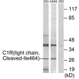 Western Blot - Anti-C1R (light chain,cleaved Ile464) Antibody (L0230) - Antibodies.com