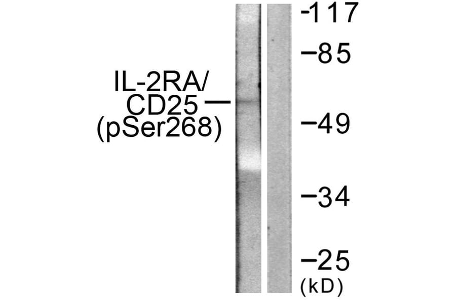 Western Blot - Anti-IL-2R alpha (phospho Ser268) Antibody (A1061) - Antibodies.com