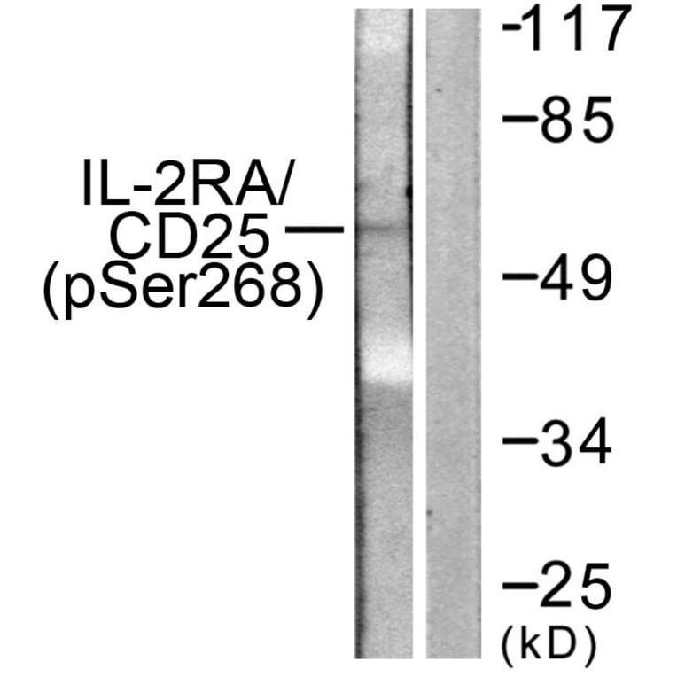 Western Blot - Anti-IL-2R alpha (phospho Ser268) Antibody (A1061) - Antibodies.com