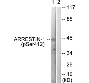 Western Blot - Anti-Arrestin 1 (phospho Ser412) Antibody (A0455) - Antibodies.com