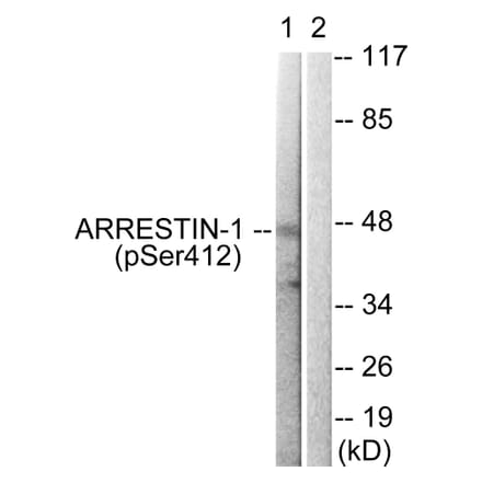 Western Blot - Anti-Arrestin 1 (phospho Ser412) Antibody (A0455) - Antibodies.com