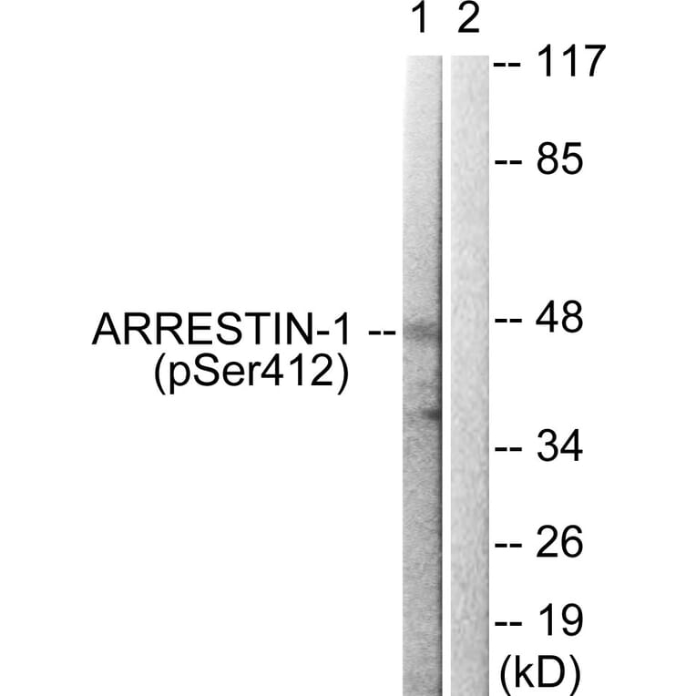 Western Blot - Anti-Arrestin 1 (phospho Ser412) Antibody (A0455) - Antibodies.com