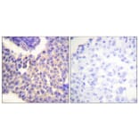 Immunohistochemistry - Anti-Arrestin 1 (phospho Ser412) Antibody (A0455) - Antibodies.com